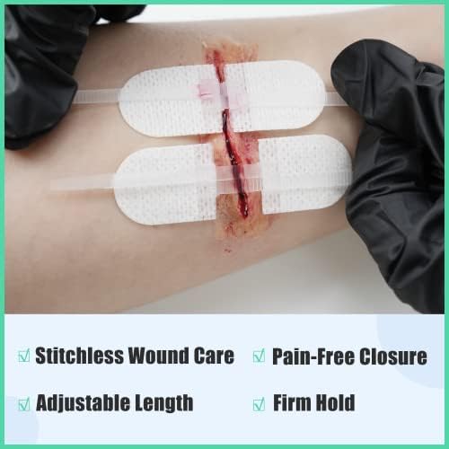 RHINO RESCUE Wound Closure Kit with 6 Stitch Zip Devices - Image 2
