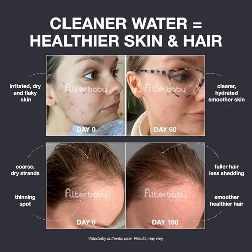 Filterbaby Diamond Shower Filter for Skin & Hair, IAPMO Tested to NSF 177 - Image 2