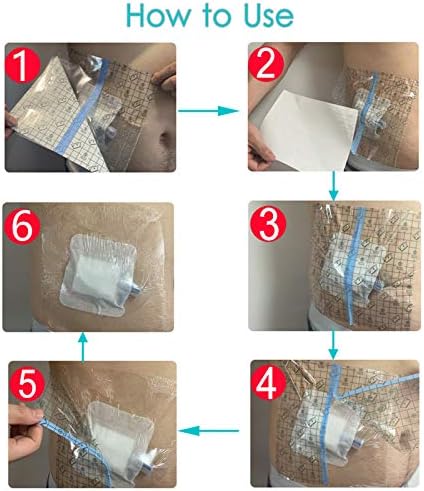 Waterproof Dialysis Catheter Shower Cover PD Catheter Shower Protector Shields with Non-Stick Center Pad for Peritoneal Dialysis Accessories Port Chest Central Line 6"x6" Pack of 25 - Image 5