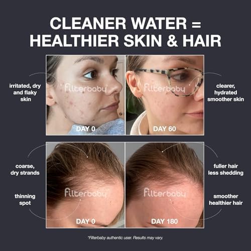 Filterbaby Diamond Shower Filter for Skin & Hair, Reduces Chlorine - Image 2