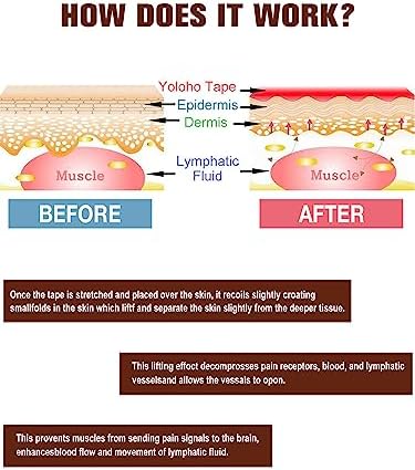 Kinesiology Tape Precut, Lychee Elastic Cotton Athletic Tape for Joint Support and Muscle Pain Relief Waterproof Breathable (Beige,4 Rolls) - Image 4