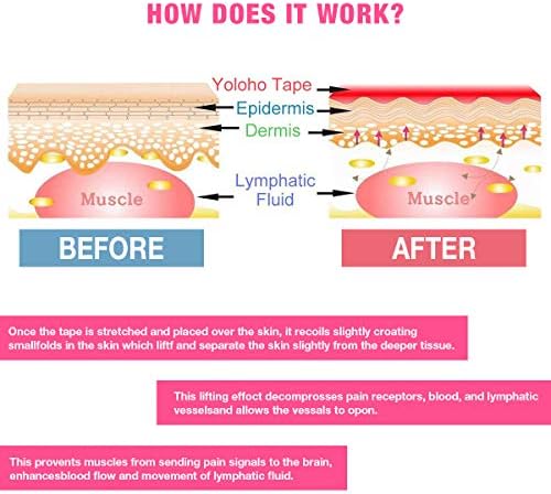 Kinesiology Tape Athletic Tape Sport Tape, Lychee Supports & Protects Muscles, Waterproof and Latex Free, Breathable Elastic for Sport Activity (5 Rolls,5 Colors) - Image 4