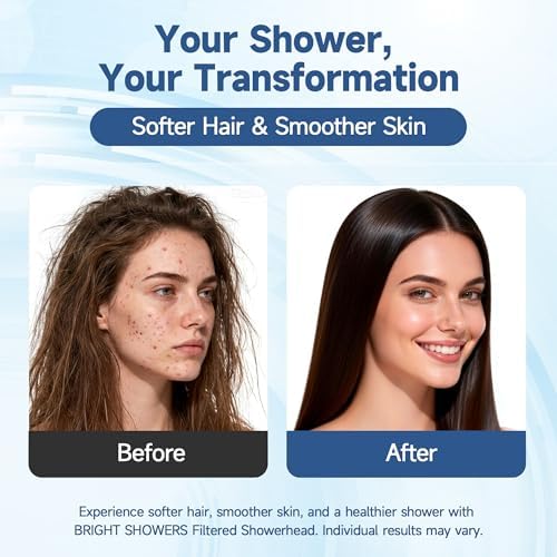 BRIGHT SHOWERS Filtered Shower Head with Handheld, High Pressure 9 Spray Mode Showerhead with Long Hose and Bracket, Water Softener Filters Beads for Hard Water - Removes Chlorine, Oil-Rubbed Bronze - Image 4